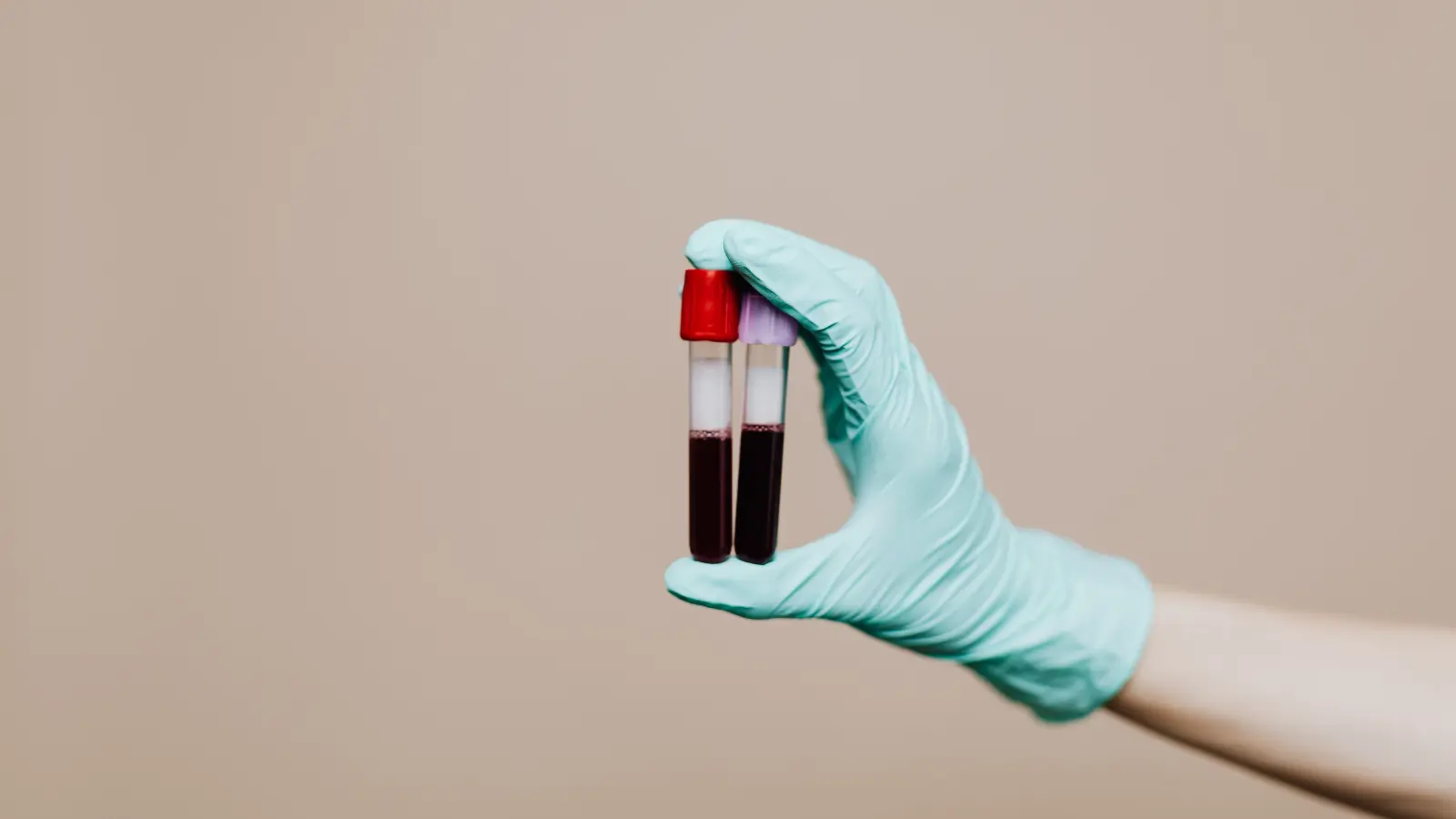 Blood Pick Up Lines